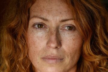 The Facts About Redheads and Pain