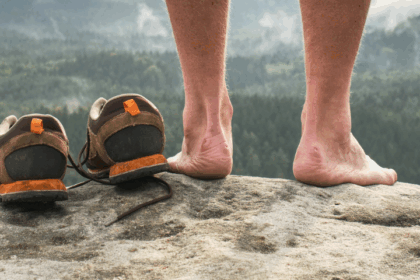Three common causes of blisters and how to prevent them